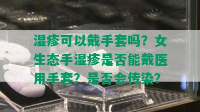 湿疹可以戴手套吗？女生态手湿疹是否能戴医用手套？是否会传染？