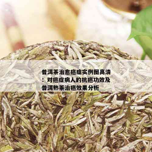 普洱茶治愈癌症实例图高清：对癌症病人的抗癌功效及普洱熟茶治癌效果分析