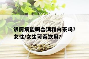 银屑病能喝普洱和白茶吗？女性/女生可否饮用？