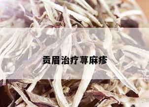 贡眉治疗荨麻疹