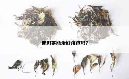 普洱茶能治好痔疮吗？