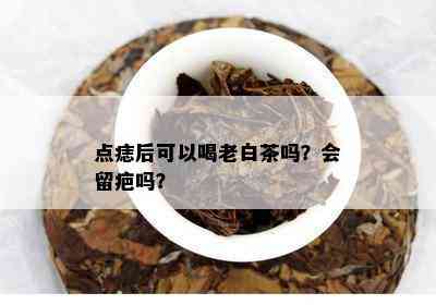 点痣后可以喝老白茶吗？会留疤吗？