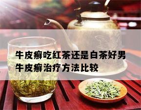 牛皮癣吃红茶还是白茶好男牛皮癣治疗方法比较