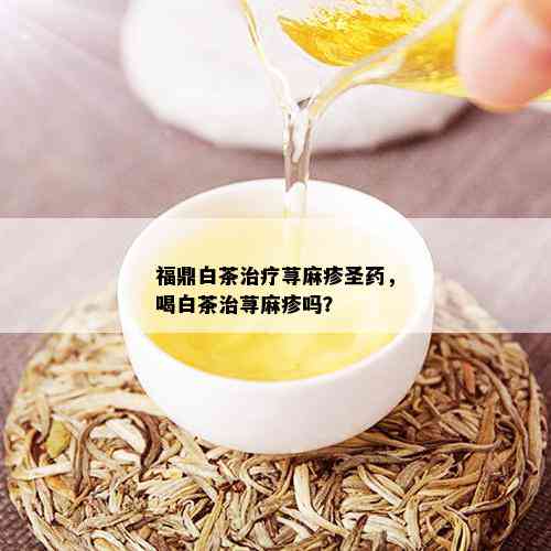 福鼎白茶治疗荨麻疹圣，喝白茶治荨麻疹吗？