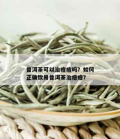 普洱茶可以治痘痘吗？如何正确饮用普洱茶治痘痘？