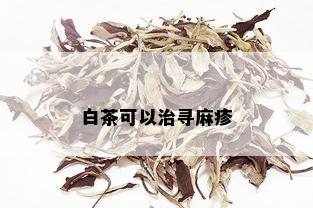 白茶可以治寻麻疹