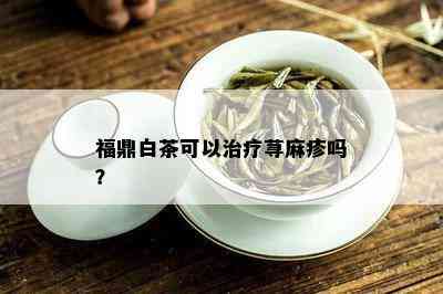 福鼎白茶可以治疗荨麻疹吗？