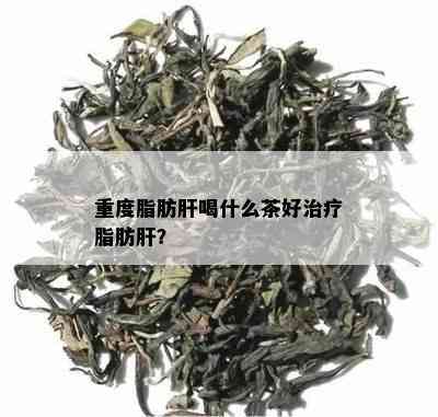 重度脂肪肝喝什么茶好治疗脂肪肝？