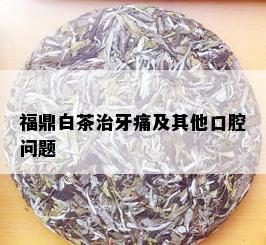 福鼎白茶治牙痛及其他口腔问题