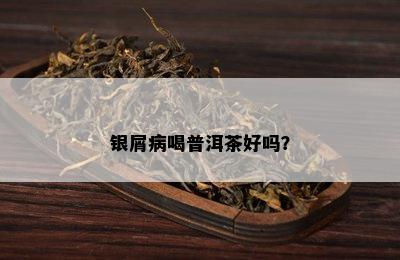 银屑病喝普洱茶好吗？