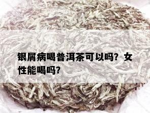 银屑病喝普洱茶可以吗？女性能喝吗？