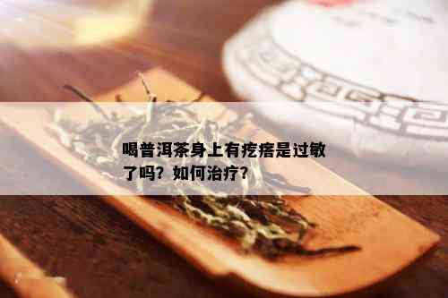 喝普洱茶身上有疙瘩是过敏了吗？如何治疗？