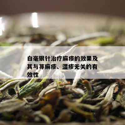 白毫银针治疗麻疹的效果及其与荨麻疹、湿疹无关的有效性