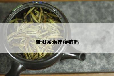 普洱茶治疗痔疮吗