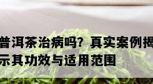 普洱茶治病吗？真实案例揭示其功效与适用范围