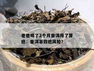 老爸喝了2个月普洱得了胃癌：普洱茶致癌风险？