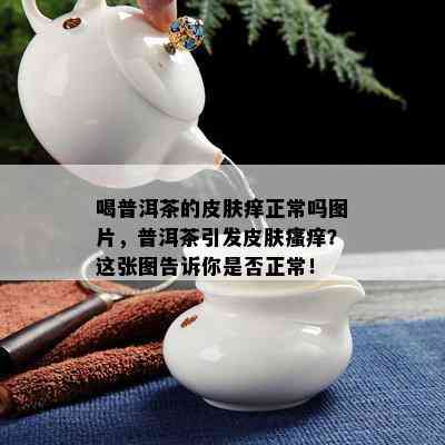 喝普洱茶的皮肤痒正常吗图片，普洱茶引发皮肤瘙痒？这张图告诉你是否正常！