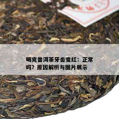 喝完普洱茶牙齿变红：正常吗？原因解析与图片展示