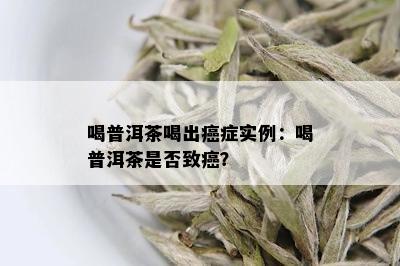 喝普洱茶喝出癌症实例：喝普洱茶是否致癌？