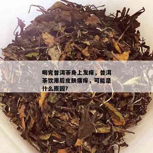 喝完普洱茶身上发痒，普洱茶饮用后皮肤瘙痒，可能是什么原因？