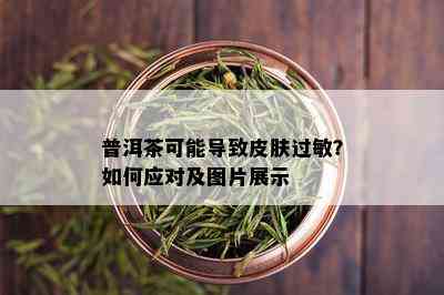 普洱茶可能导致皮肤过敏？如何应对及图片展示